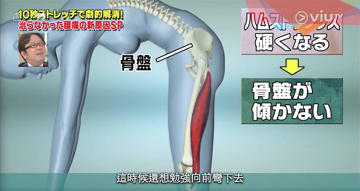 腰痛 腿後腱太硬腳筋太硬）會增加腰部負荷，長久下去會引致腰痛
