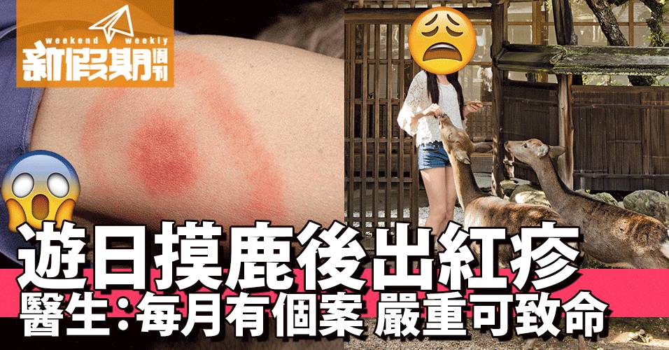 加劇M痛｜11款韓國衛生巾含有毒物質 部分香港有售 @GOtrip