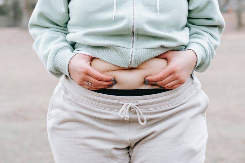 有4成左右肥胖人士患有脂肪肝。