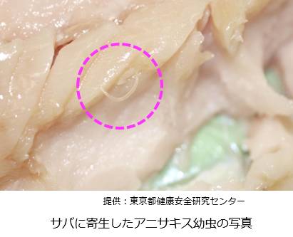 壽司 寄生在鯖魚的海獸胃線蟲幼蟲。