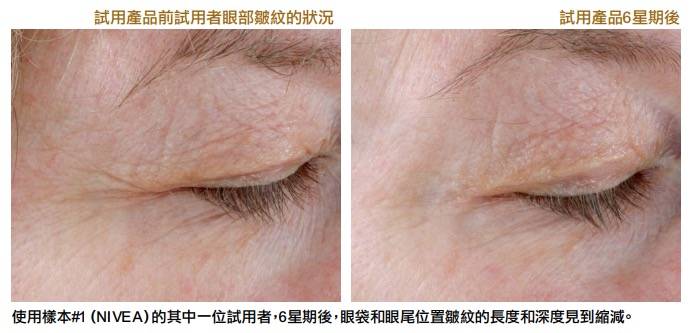 消委會眼霜 使用樣本#1NIVEA）的其中一位試用者，6星期後，眼袋和眼尾位置皺紋的長度和深度見到縮減。