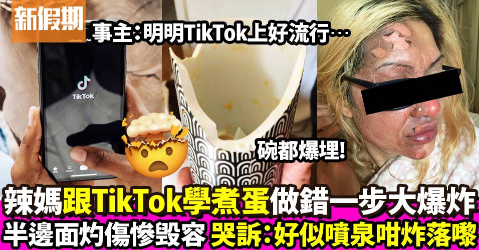 英國媽媽TikTok學煮蛋卻變炸蛋微波爐大爆炸！半邊面灼傷慘毁容