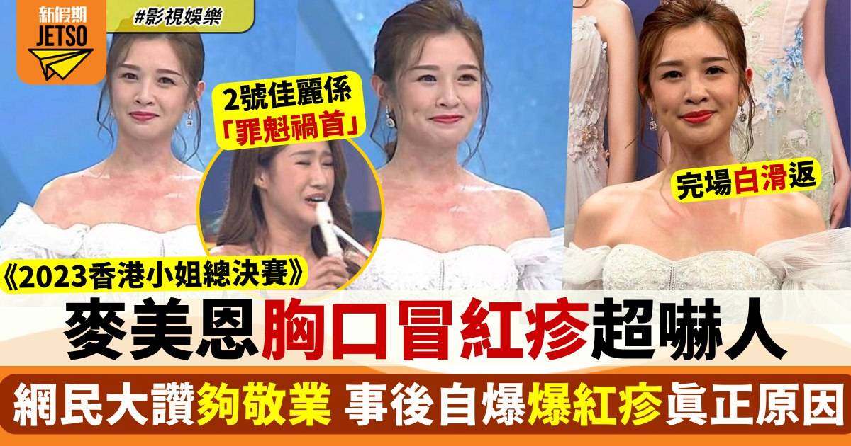 香港小姐2023︱麥美恩胸口發紅令人憂心 當事人6字解釋兼爆「元兇」