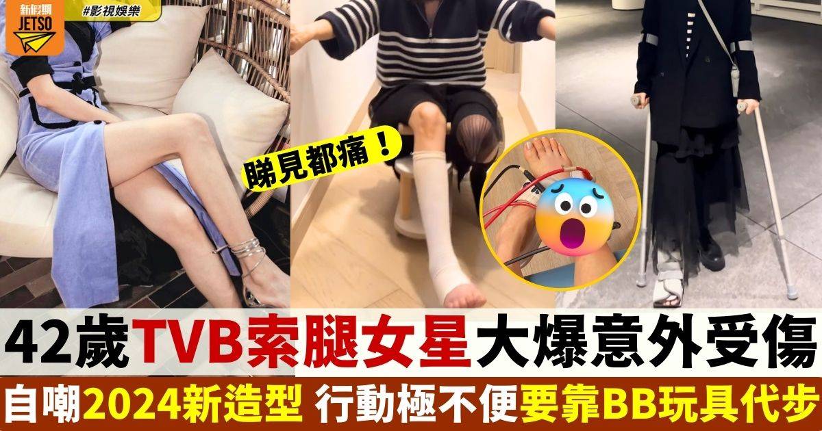42歲TVB索腿女星自爆受傷 行動極不便要借BB玩具代步