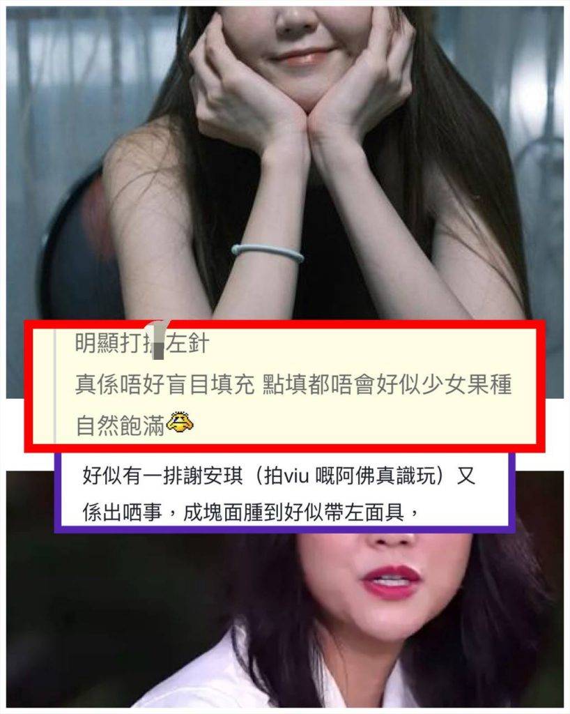 吴若希 jinny 不少网民直指吴若希面肿是因为「打咗针」，更以谢安琪早年的面部状况作为例子。（图片来源：IG@jinnyng、ViuTV截图）