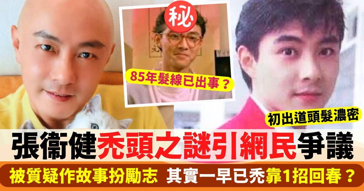 張衞健禿頭之謎引爭議  被質疑作故事扮勵志  其實一早已禿靠1招回春？！