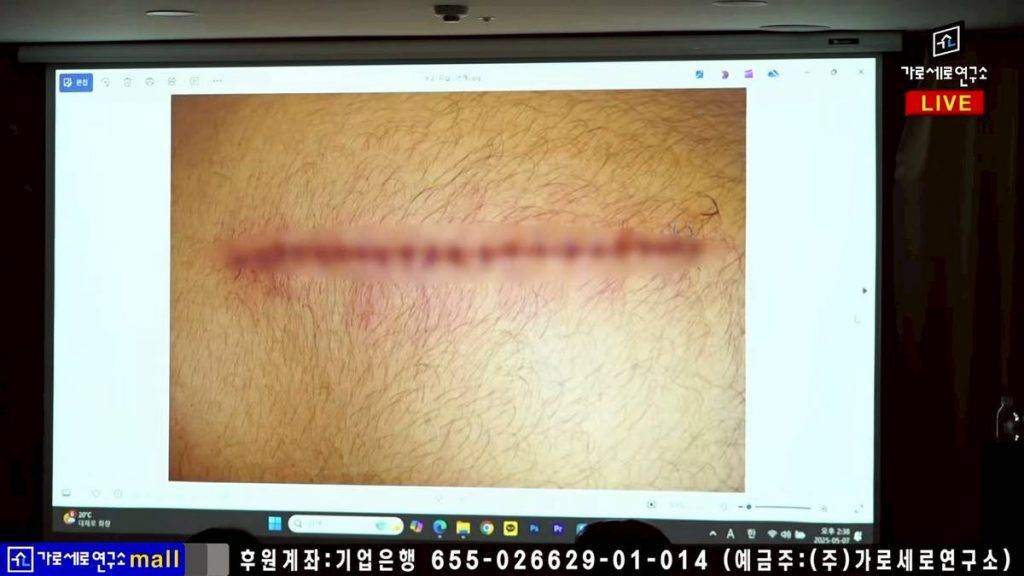 金秀賢 金賽綸 提供錄音嘅爆料者更自稱在5月1日於美國遭兩名亞裔男子持刀襲擊,頸部被刺9次。(圖片來源:《橫豎研究所》)