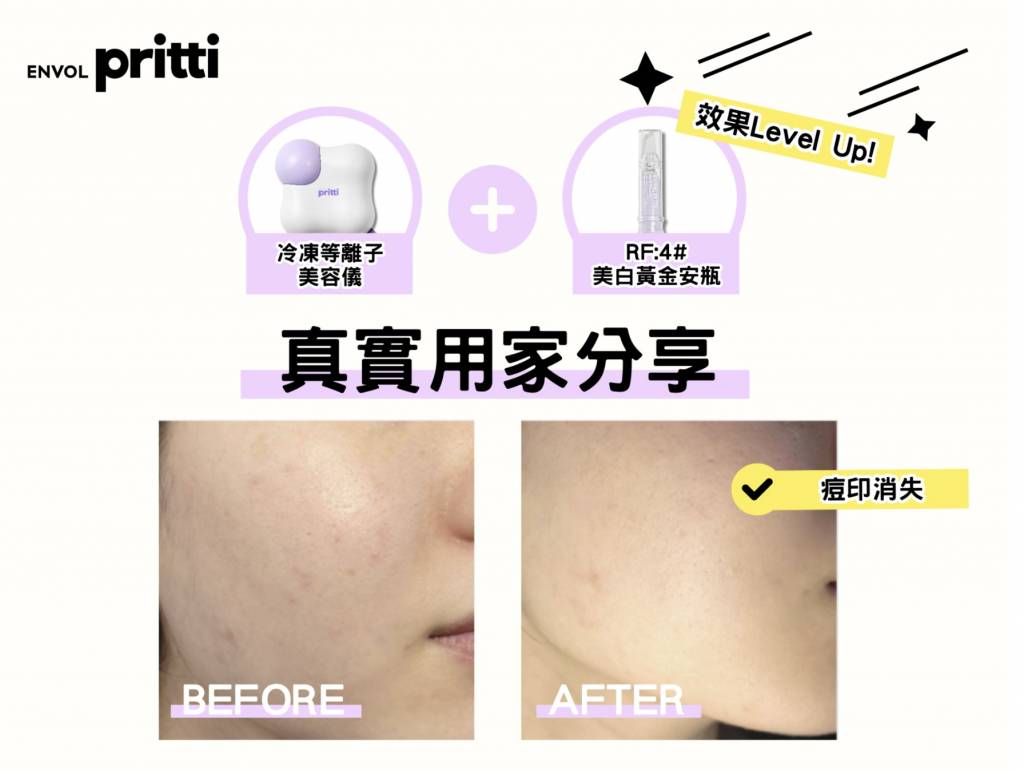 Pritti美容產品評價 (圖片來源:友和YOHO官網)