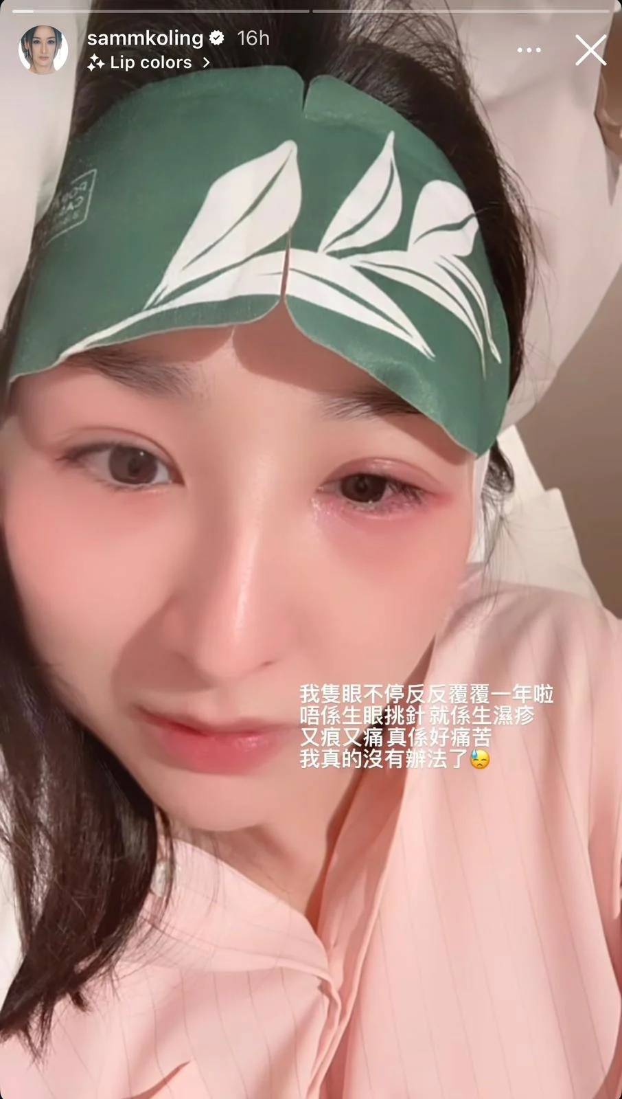 高海寧 眼疾 高海寧在IG限時動態公開自己左眼紅腫的短片,只見她一臉倦容、眼睛又紅又腫,令人心痛(圖片來源:高海寧IG)