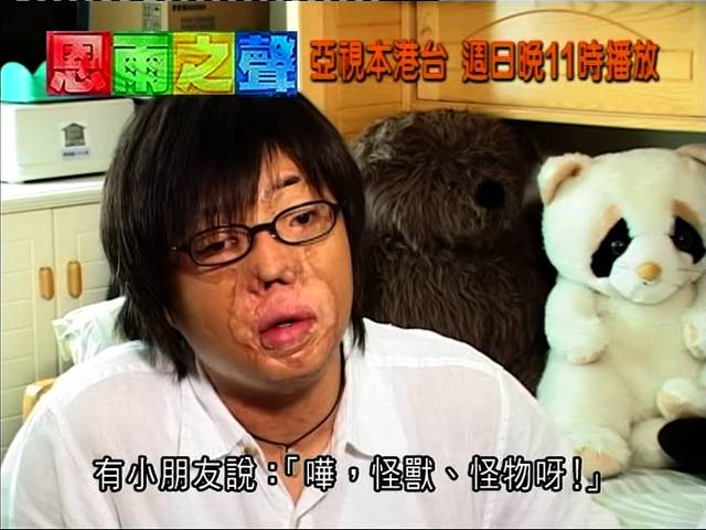 八仙嶺山火 生還者 (圖片來源:YouTube@恩雨之聲 香港 SOBEM HK)