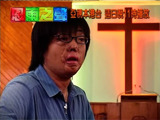 八仙嶺山火 生還者 (圖片來源:YouTube@恩雨之聲 香港 SOBEM HK)