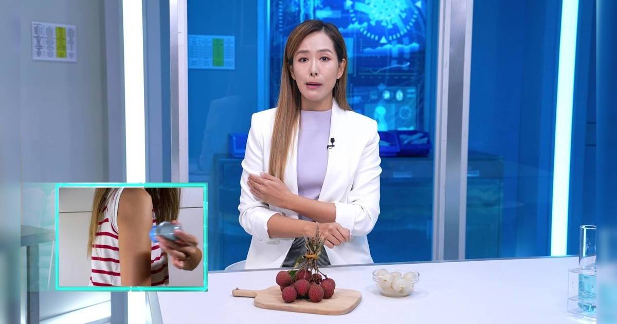 《東張》女神吳幸美搏盡！為節目實測手臂拮3cm長針 驚爆拔出後「係咁標血有個窿」畫面超震撼！