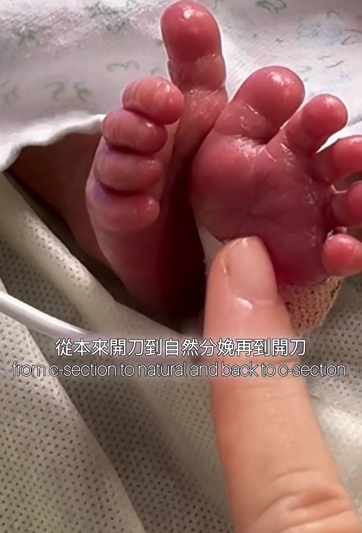 利穎怡 東張西望 (圖片來源:IG@joannyle)