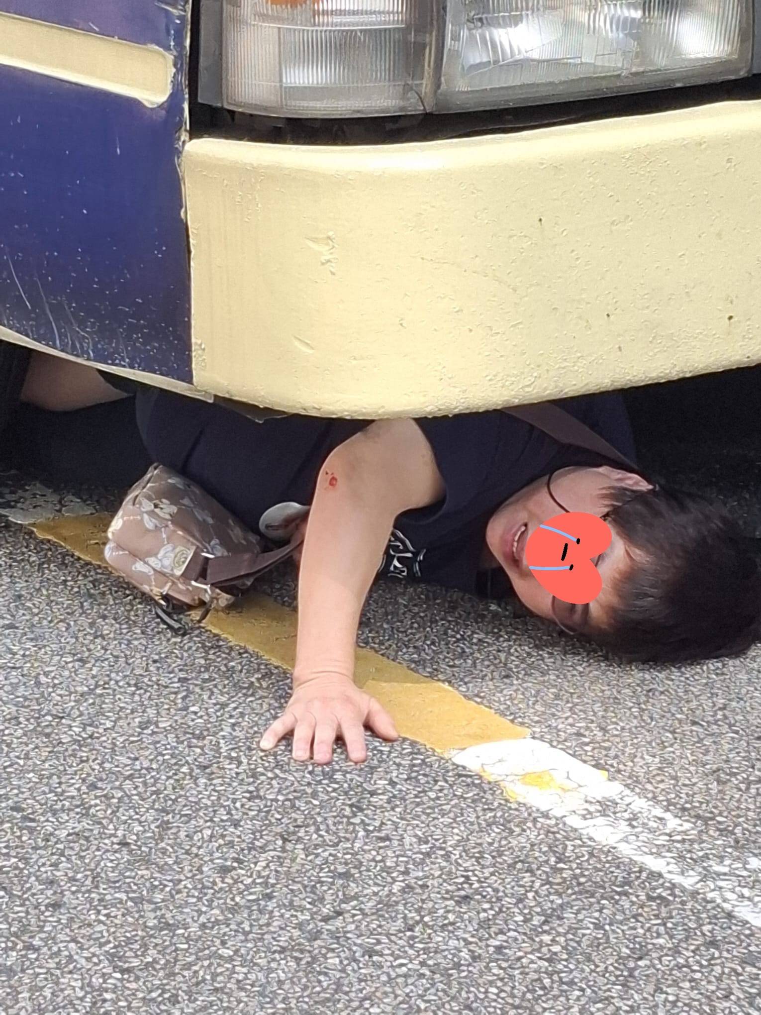 荃灣 交通意外 女子被捲入車底,由網上圖片可見,女子幾乎整個人被困車底,但她仍然清醒,露出驚恐表情。(圖片來源:香港突發事故報料區及討論區)