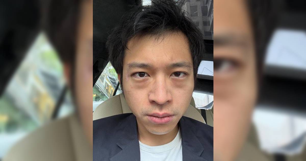 林作獲保釋後首發文最「擔心」一件事 囂張炫耀本性不改：這就是我實力