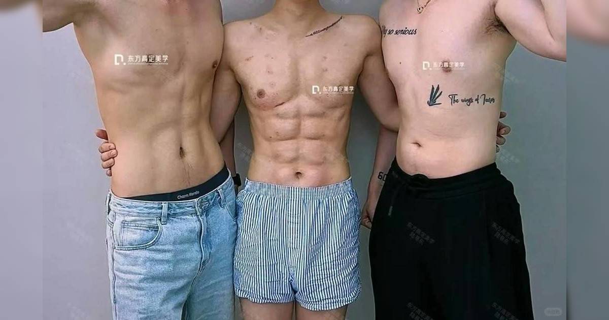 內地男洗7位數打造人工腹肌｜注射40支玻尿酸 醫生警告恐有這後果