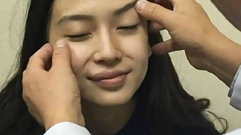 angelababy 煙燻妝 2015年Angelababy素顏上陣接受整形醫生的面部鑑定,指沒有切口痕跡。(圖片來源:愛奇藝影片截圖)