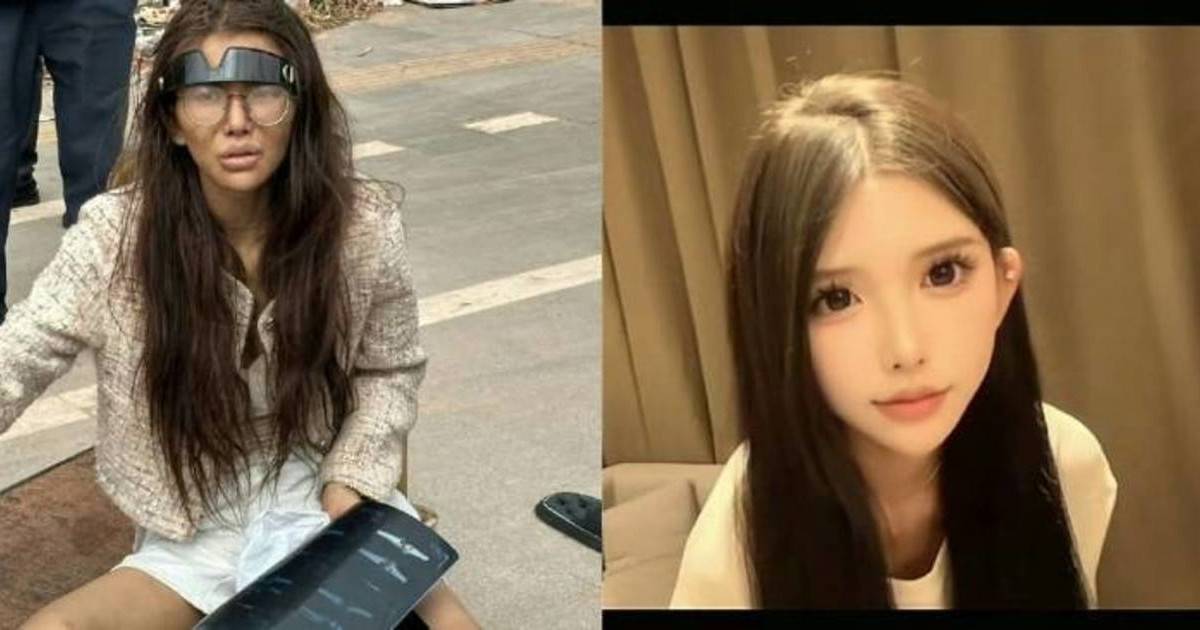 20歲網紅被男友騙至柬埔寨｜高薪美夢成空 雙腿骨折極落魄