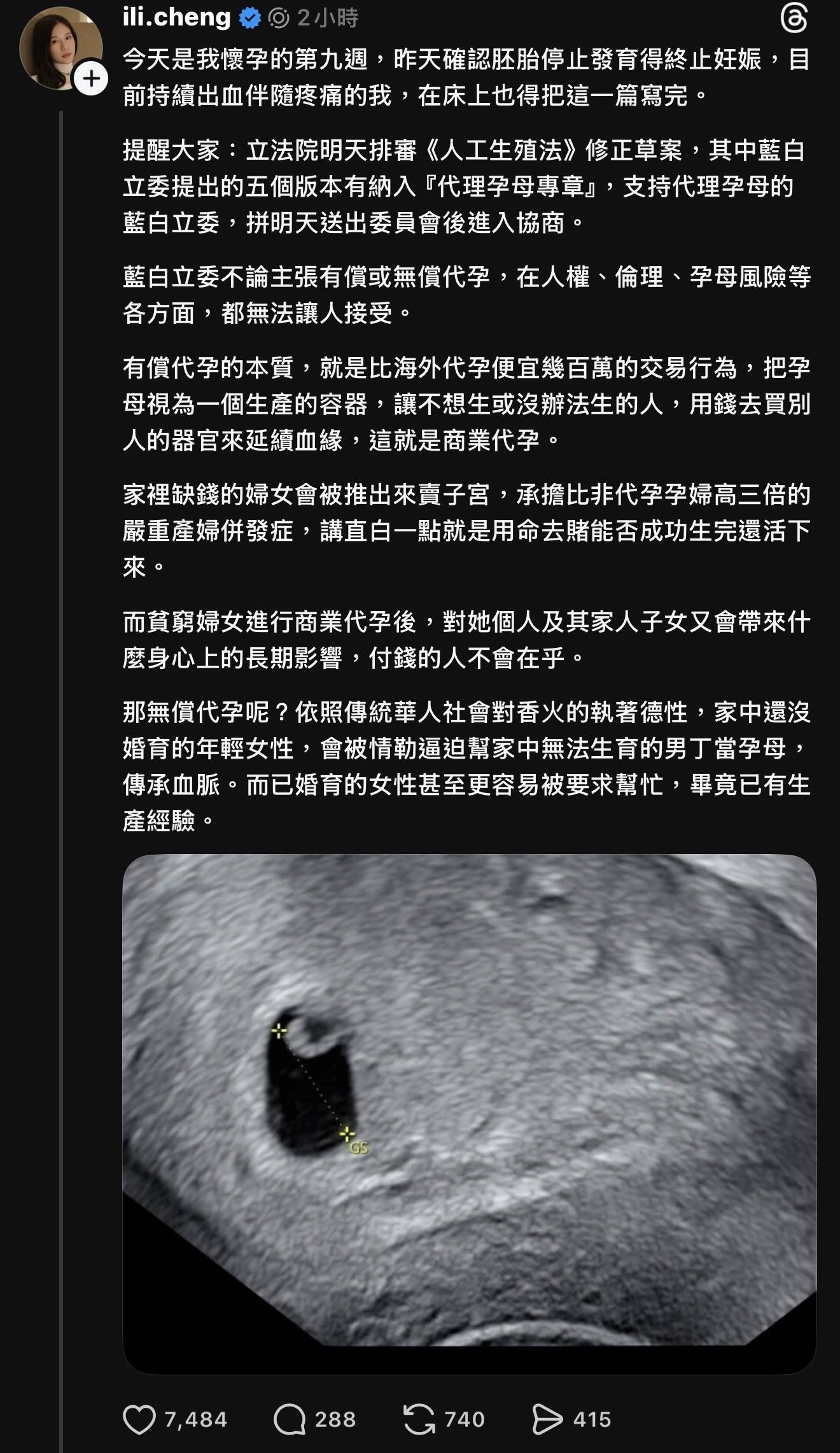 雞排妹 流產 (圖片來源:threads)