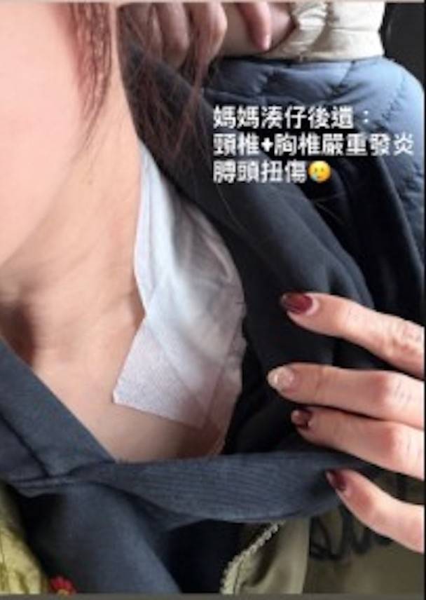 孫慧雪 湊仔後遺症 (圖片來源:小紅書)