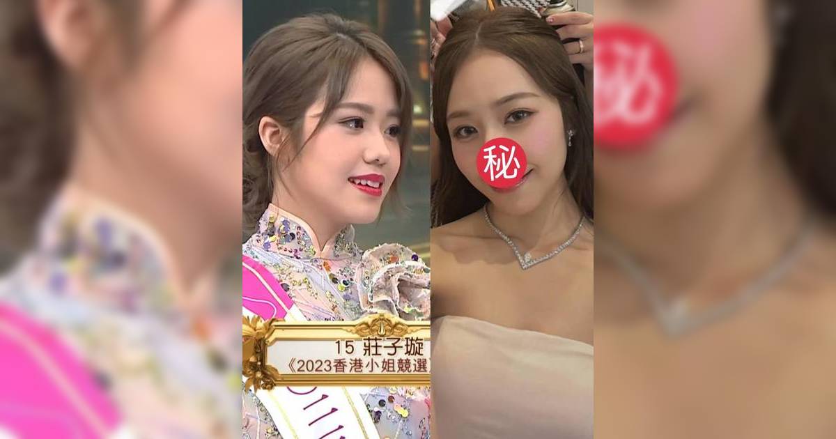 莊子璇靚樣升級至5.0 秒變「鷹鼻」撞樣林嘉欣 網民驚呼：又唔同咗