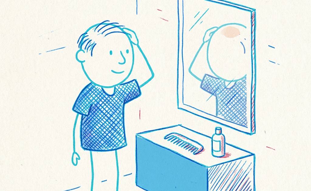 【地中海禿頭】中間通頂點算好？拆解戴帽甩頭髮迷思成因及治療全攻略