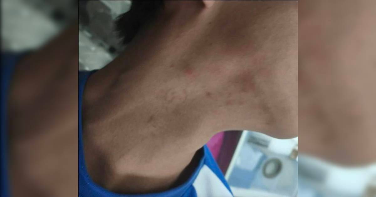 中一男生多處受傷入院被勒索5位數 爆料者：媽媽極心痛絕不姑息 網民去信涉事學校