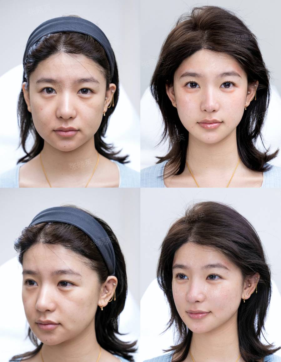 香港小姐2026 溫思婷 (圖片來源:小紅書@上扬美学|张晓英)
