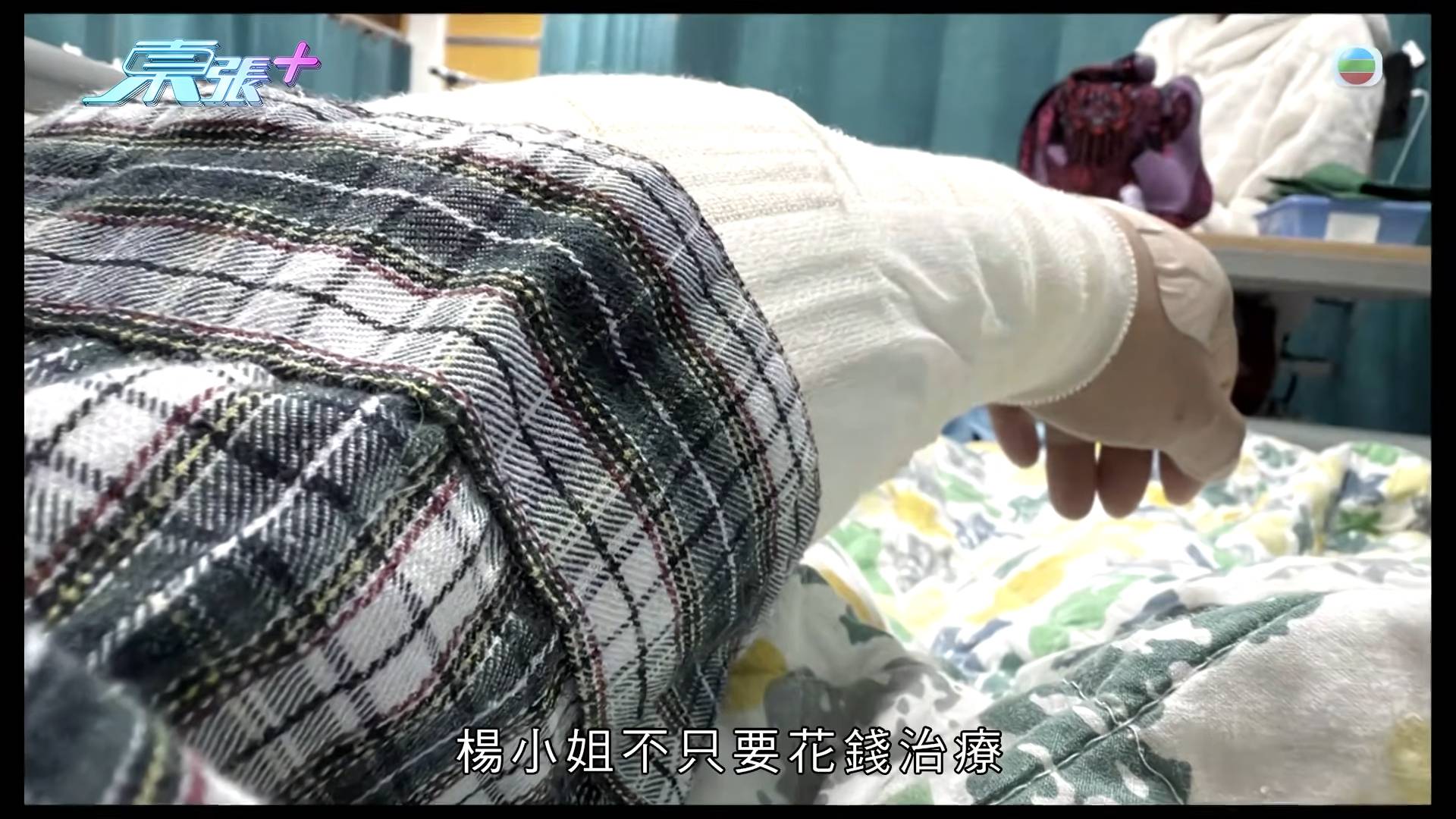 東張西望 惡犬傷人 兩年前楊小姐在家門外遭鄰居的惡犬突然發狂狂咬,手腳均受傷,其中拇指傷勢極嚴重要縫 6 針。(圖片來源:TVB)