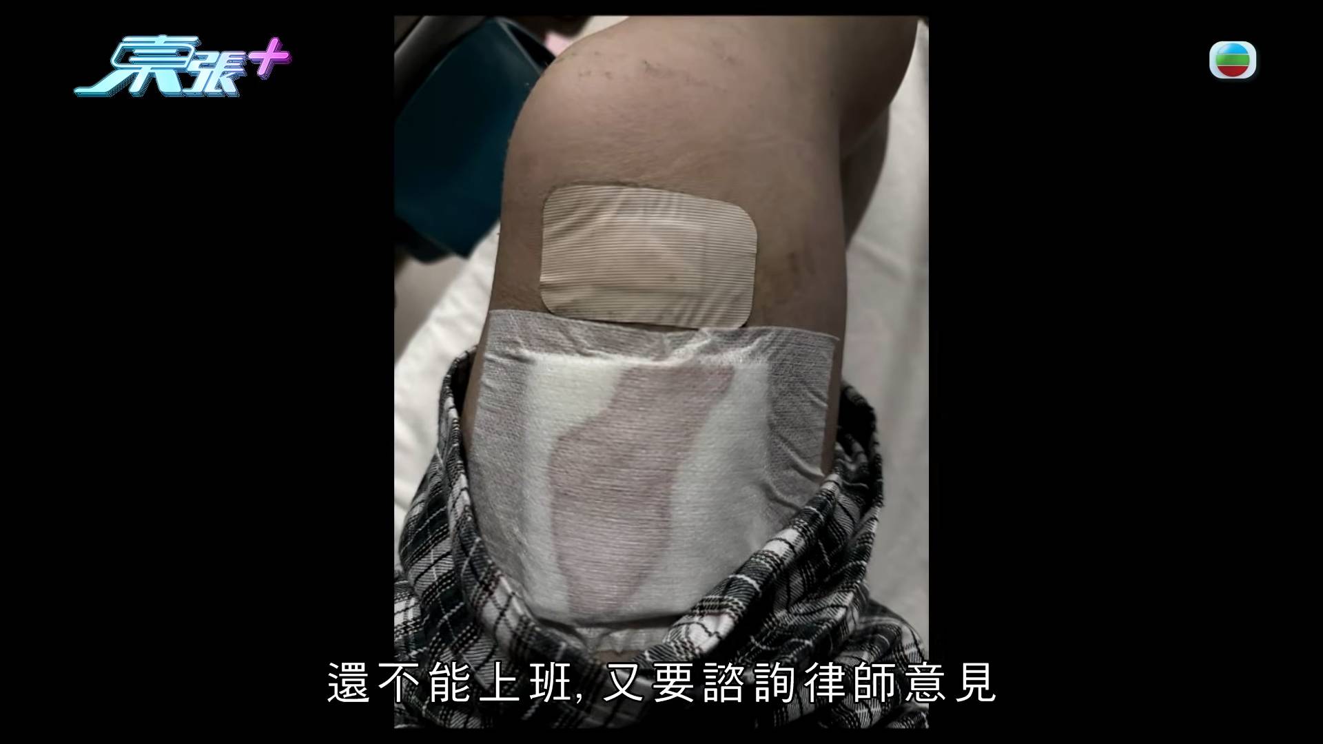 東張西望 惡犬傷人 楊小姐因傷徹底失去工作能力,加上持續的精神科與復康醫療開支,令她的生活雪上加霜。(圖片來源:TVB)