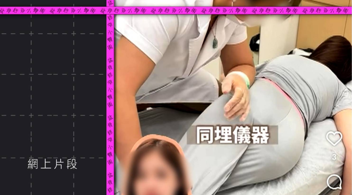 東張西望 中風 葉小姐聲稱因貪靚覺得自己臀部大而接受盆骨修窄小臀術。(圖片來源:TVB)