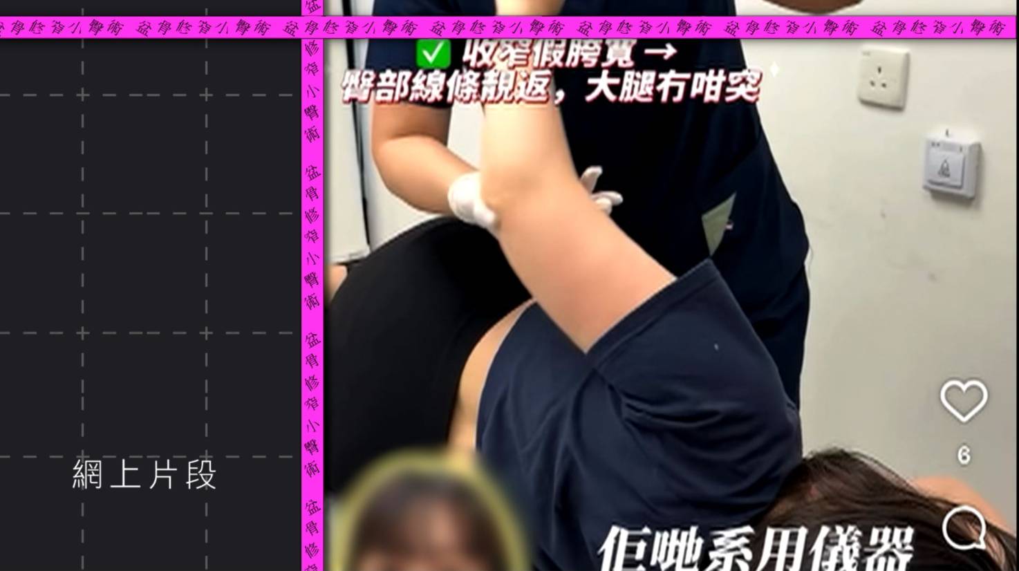 東張西望 中風 葉小姐指治療師曾幫她拉肩頸。(圖片來源:TVB)