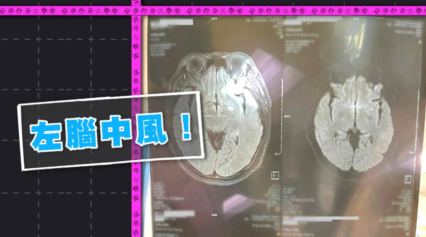 東張西望 中風 葉小姐因身體麻痺求醫被證實腦中風。(圖片來源:TVB)