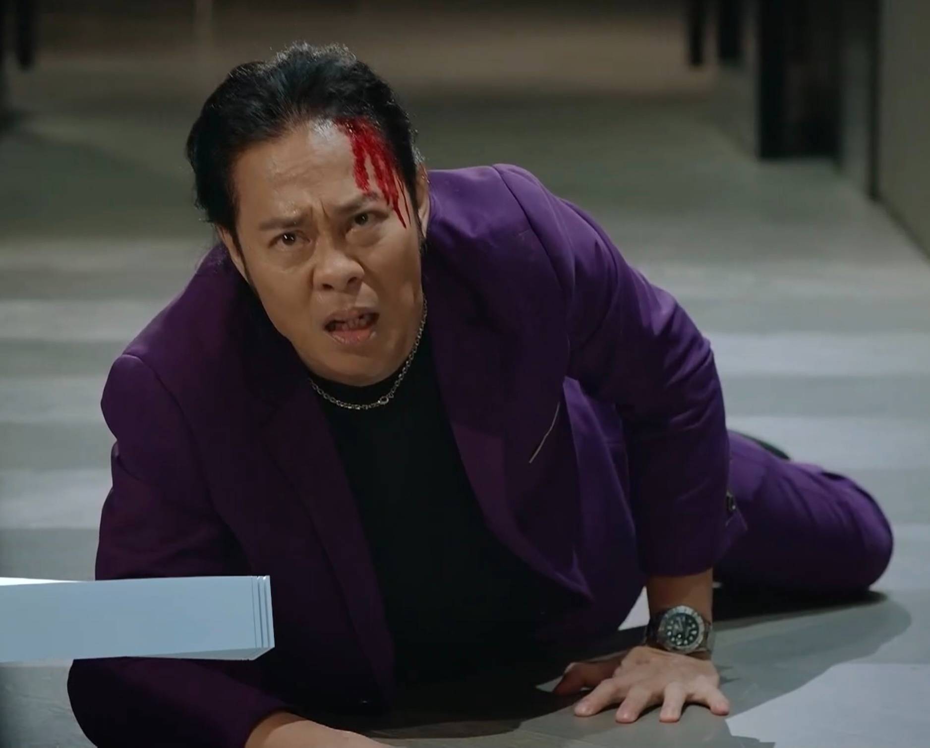 璀璨之城 蔣家旻 滿頭鮮血!(圖片來源:TVB)